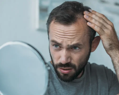 Is Your Hair Loss Normal? Understanding the Signs and Finding Solutions 11